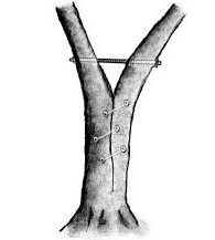 treebrace